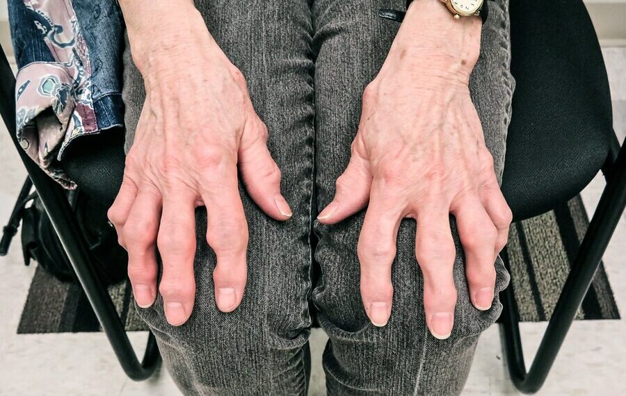 Почему кисти рук становятся синими: основные причины и как справиться с этим